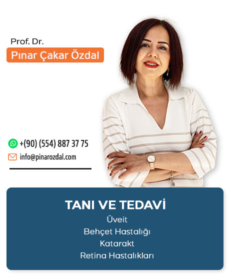 ankara-uveit-uzmani